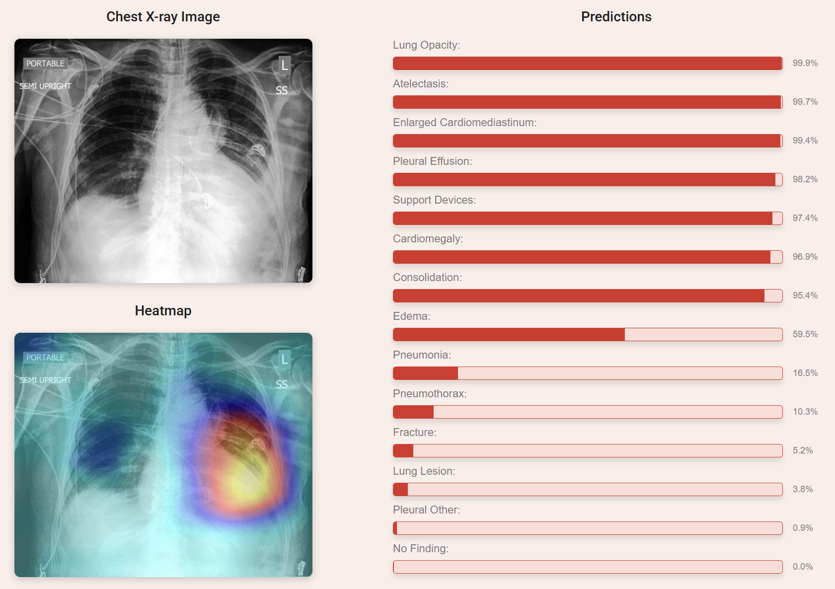 xray